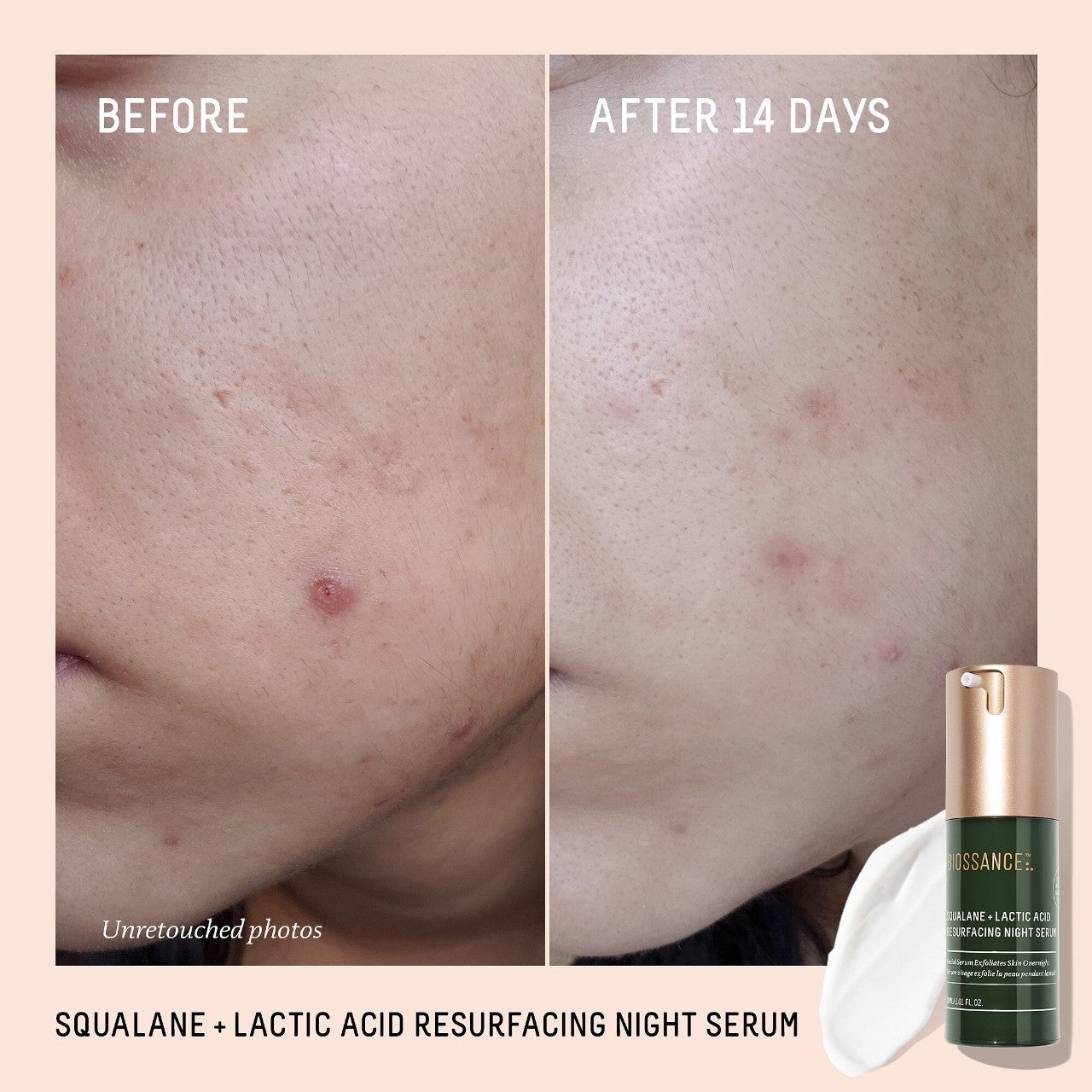 Biossance's Squalane + 10% Lactic Acid Resurfacing Serum
